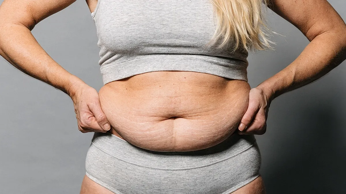 Benefits of a Tummy Tuck after Pregnancy