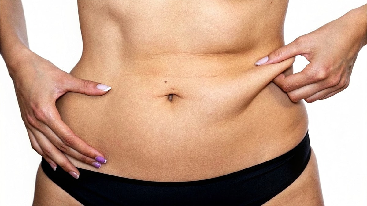 Drainless Tummy Tuck: The Pros and Cons Blog Image at Body by Ravi - Close-up of a person's bare abdomen