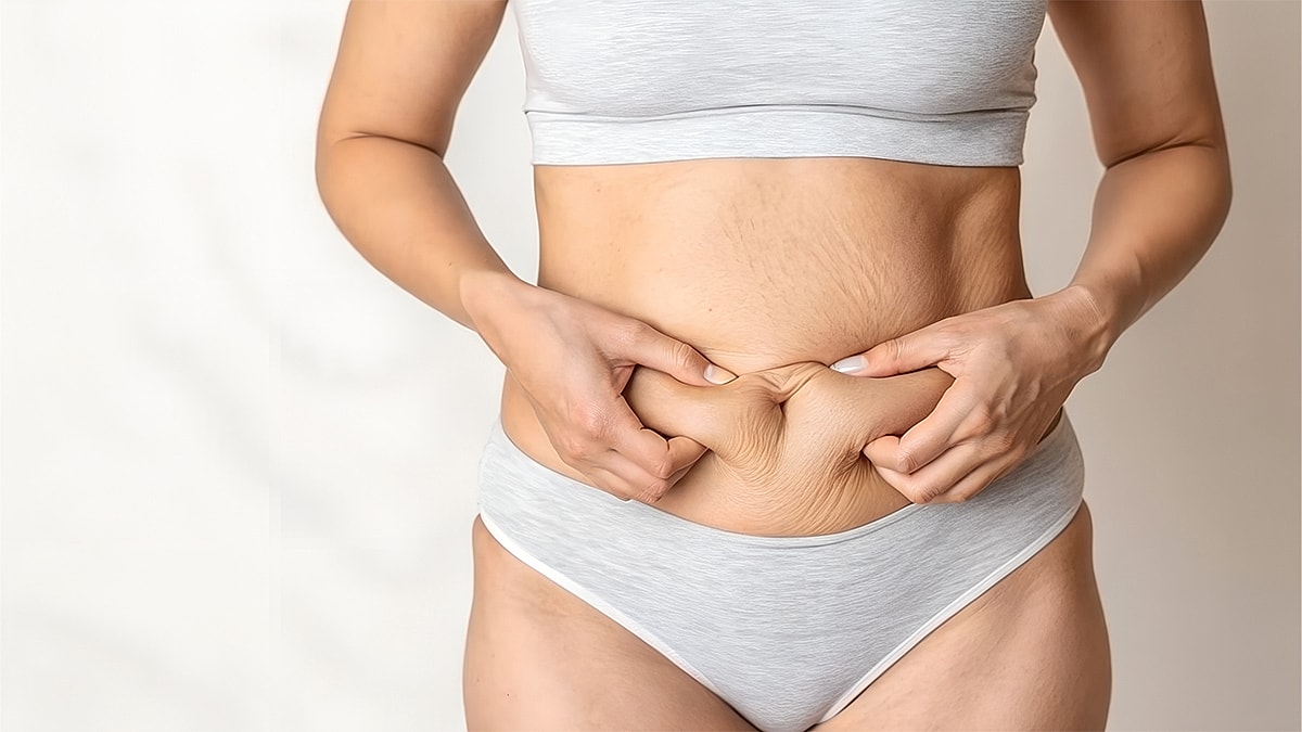 Mini vs Full Tummy Tuck in Houston - Woman holding skin on her abdomen