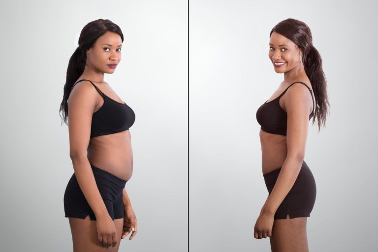 The Top Five Reasons to Undergo High-Def Liposuction