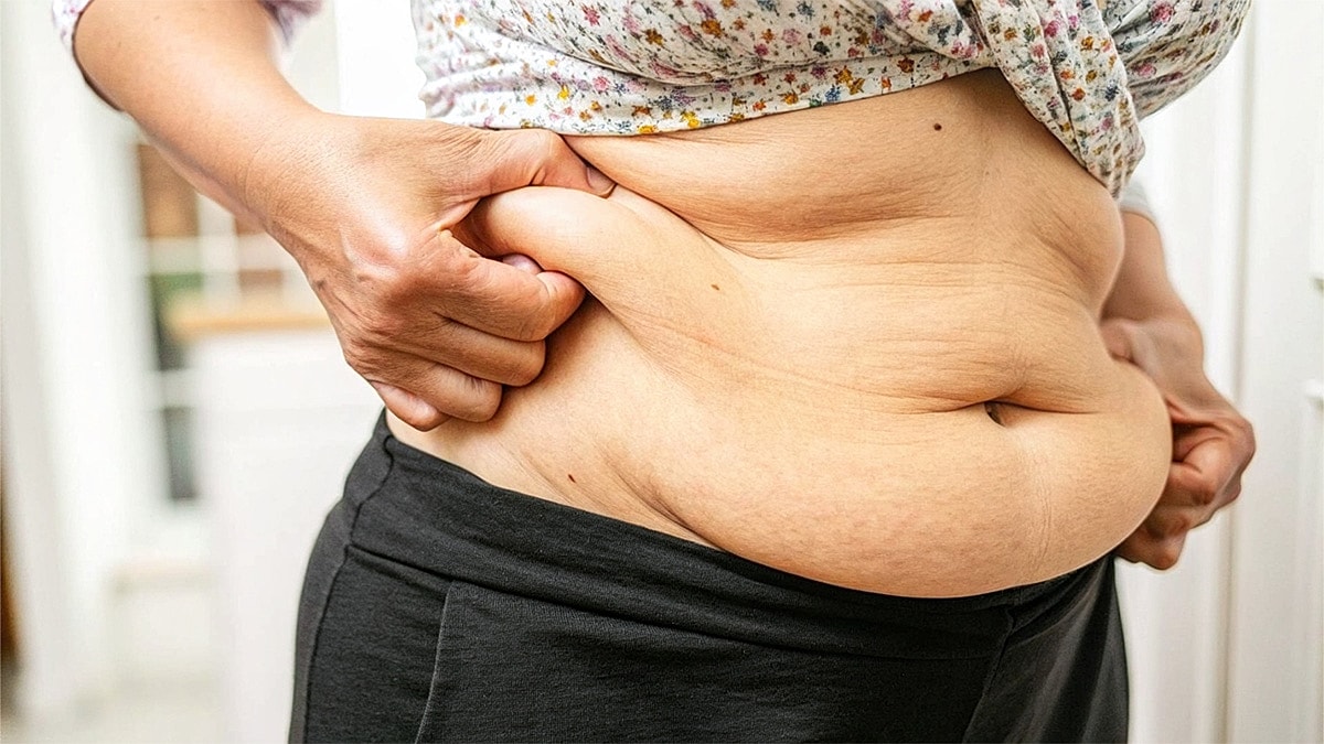 Tummy Tuck vs. Panniculectomy for an Apron Belly - Woman holding and pinching abdominal skin.