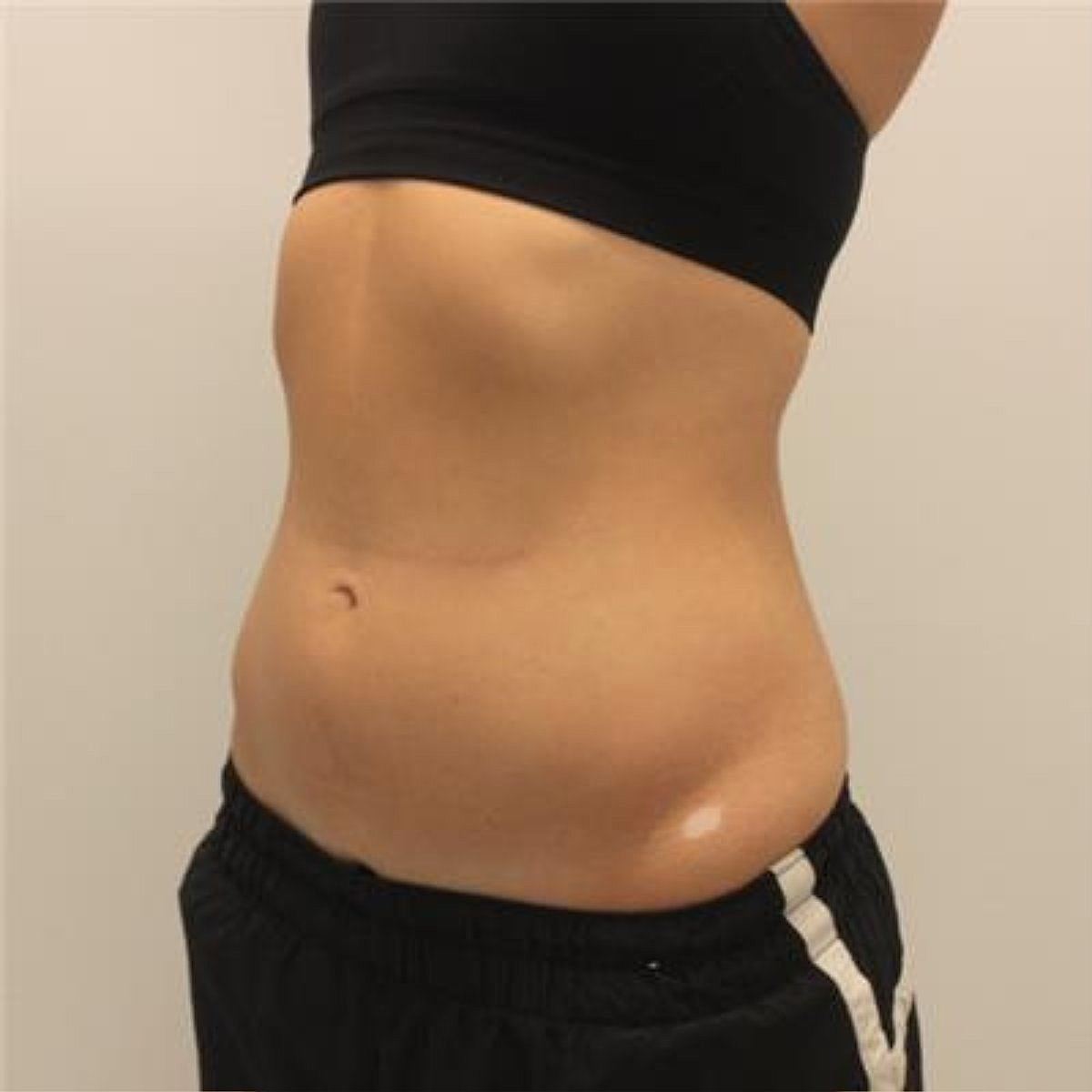 Evolve Before & After