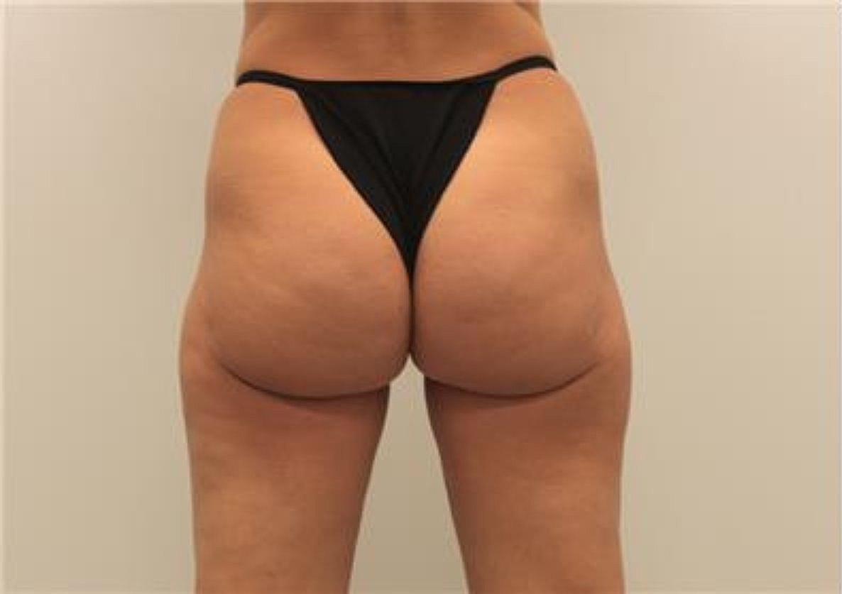 Evolve Before & After