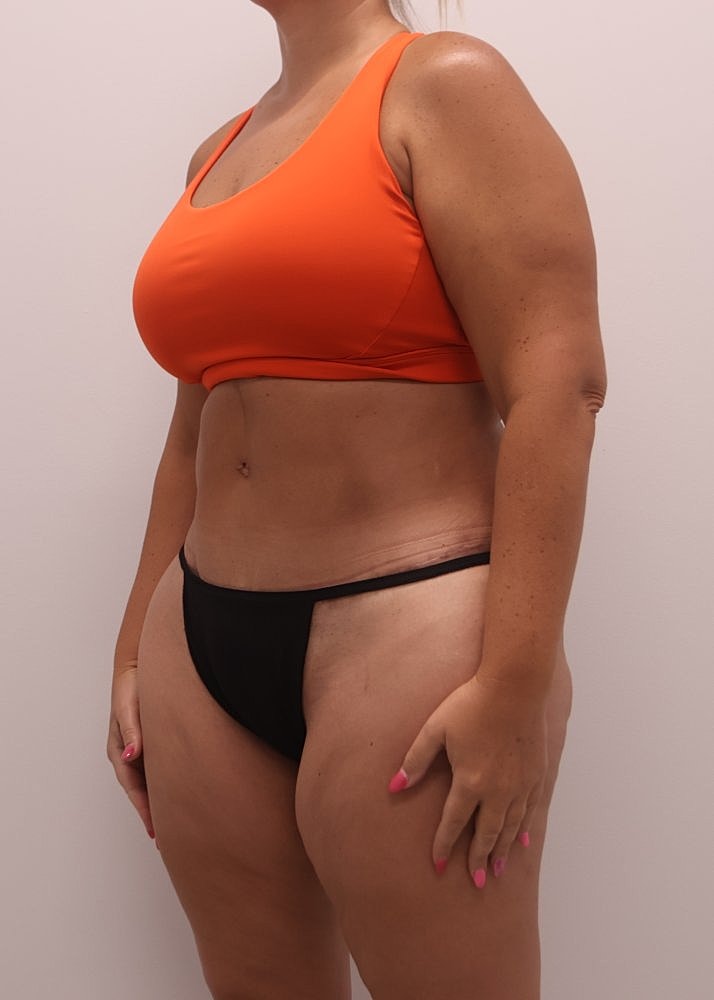 MEDICAL WEIGHT LOSS PROGRAM Before & After