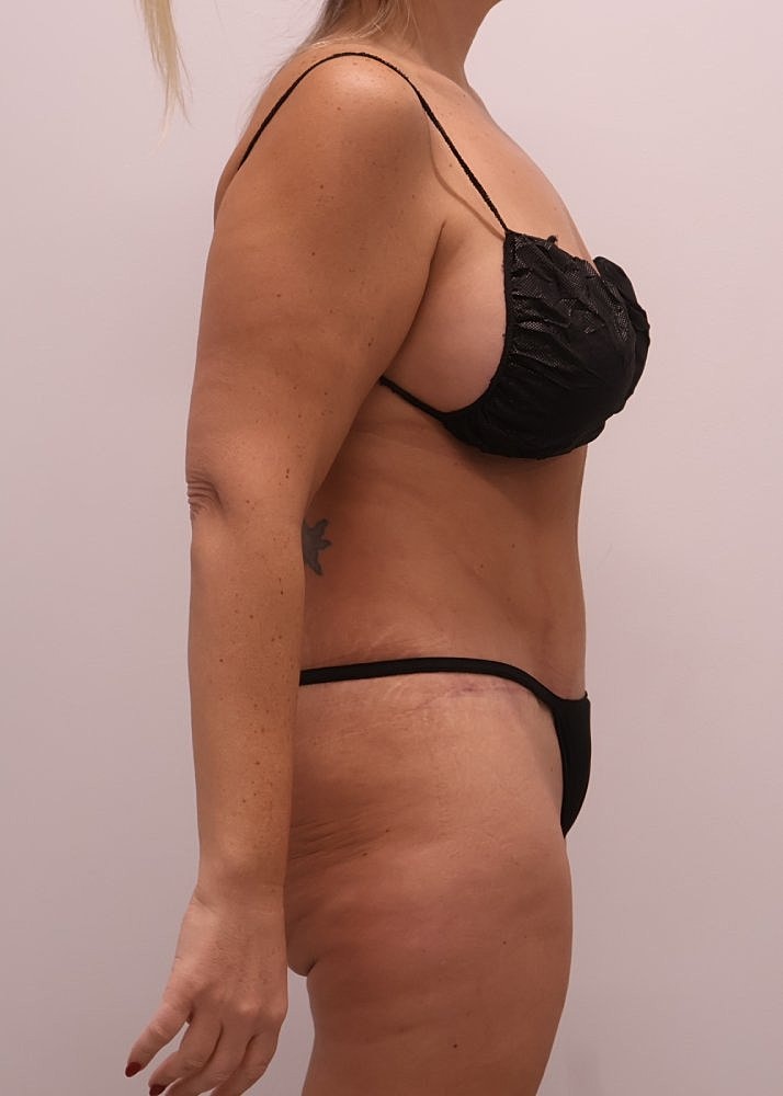 MEDICAL WEIGHT LOSS PROGRAM Before & After