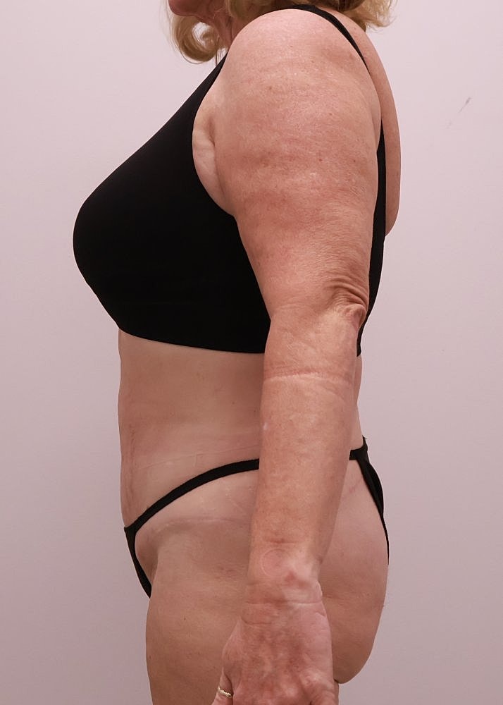 MEDICAL WEIGHT LOSS PROGRAM Before & After