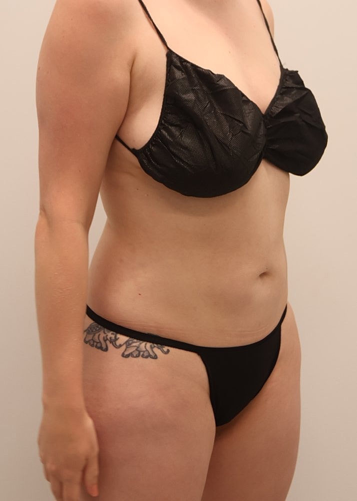 MEDICAL WEIGHT LOSS PROGRAM Before & After