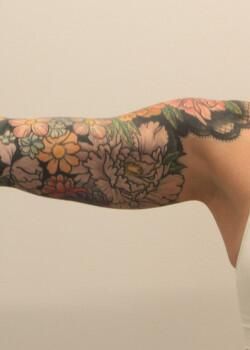 Arm Liposuction Before & After