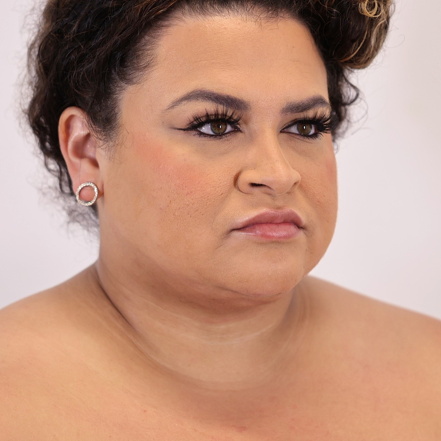 Neck Liposuction Before & After