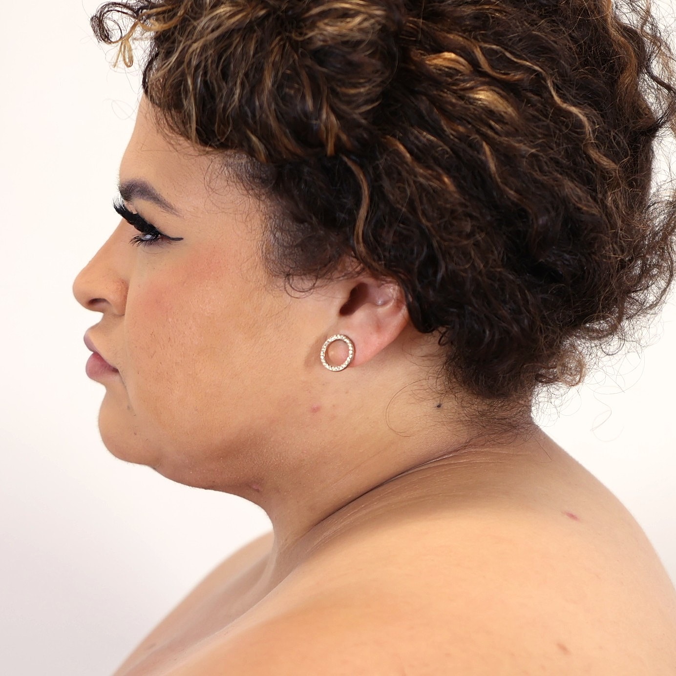 Neck Liposuction Before & After